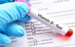 25-羥基維生素D-磁微?；瘜W(xué)發(fā)光法（AE/AP） /熒光免疫層析解決方案（雙抗體夾心法）