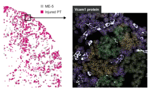 解密腎臟微環境對腎損傷有哪些影響