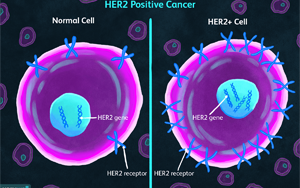《自然醫學》：一種可以顯著延長乳腺癌患者生命的新藥