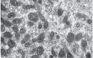 《科學轉化醫學》：2型糖尿病患者的肌肉能量產生是如何受損的