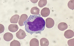 PNAS首次表明：人體組織中駐留在肺部的NK細胞在代謝方面與血液中循環的NK細胞不同