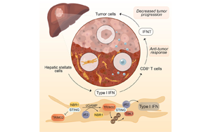肝癌免疫治療成功的生物標志物