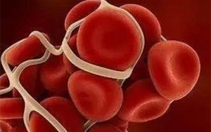 胃蛋白酶原II（PGII）-磁微粒化學(xué)發(fā)光法（AE/AP）/熒光免疫層析解決方案（含保護(hù)劑評(píng)估）