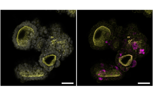 Cell：突破類器官研究限制！利用所有關(guān)鍵的胰腺細(xì)胞創(chuàng)造了一個(gè)新的類器官
