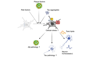 《Neuron》阿爾茨海默氏癥背后隱藏的罪魁禍首：顯微鏡下看小膠質細胞