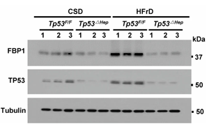 《Nature》脂肪肝為什么會導致肝癌？