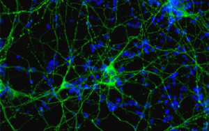 《Nature Medicine》可溶性 tau 聚集體的新發現