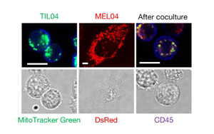 《Nature》在癌細胞中發現令人驚訝的新免疫逃避機制