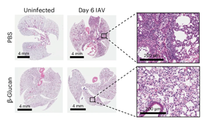 Nature Immunology：重新平衡免疫系統