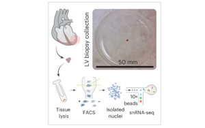 Nature Cardiovascular Research：心臟炎癥的關鍵差異
