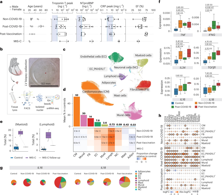 非COVID-19、COVID-19后以及疫苗接種后的炎癥性心肌病具有獨特的細胞和分子特征