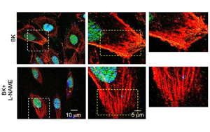 S-亞硝基化修飾 EZH2：調(diào)控內(nèi)皮穩(wěn)態(tài)的新機(jī)制與潛在治療靶點