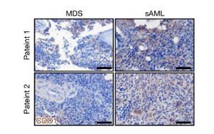 Nature：牛磺酸能推動白血病癌細胞生長！