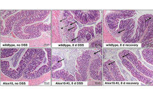 ALOX15功能人源化通過提升RvD5生成緩解小鼠結腸炎但不影響足爪水腫的機制研究