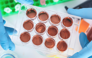 體外診斷試劑用重組人源血清基質系列產品