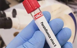 副流感病毒（HPIV1、2、3型）抗原檢測-免疫層析 （膠體金、彩色乳膠及熒光免疫層析）解決方案