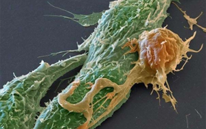 CAR-T療法和關鍵原料