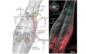 揭示自主神經(jīng)反射異常（AD）的神經(jīng)元架構(gòu)：脊髓損傷后惡性高血壓發(fā)作的機制與神經(jīng)調(diào)控治療新策略