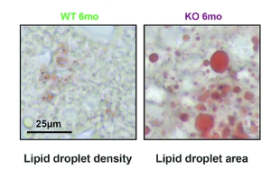 α-酮戊二酸通過調控胰島素-ATM信號軸改善共濟失調毛細血管擴張癥小鼠模型的胰島素抵抗和代謝紊亂