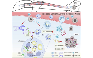 IL33誘導成熟低密度中性粒細胞脂滴形成驅動結直腸癌肝轉移的機制與治療新策略