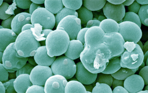 工程化產丁酸酵母通過協同作用改善阿爾茨海默病相關表型