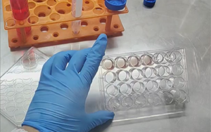 精準營養，塑造未來：類器官培養基的新紀元