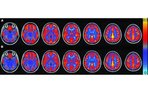 AJCN：要長壽，常吃豆！長期食用大豆飲食可讓大腦“更靈光”