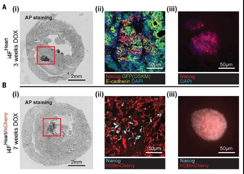 Science重磅：局部重編程讓心肌細(xì)胞“返老還童” 讓心臟實(shí)現(xiàn)再生！