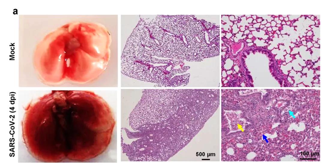 ?建模成功！Nature子刊：成功建立新冠肺炎重癥模型，揭示新冠病毒感染的分子機制