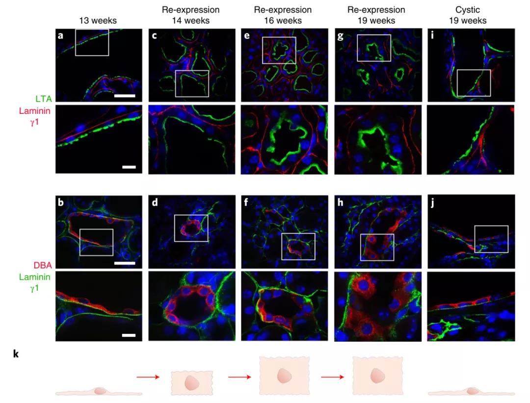 無需腎移植！Nature子刊：科學家通過逆轉小鼠多囊腎病揭示腎臟的可塑性