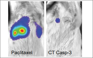 Nature子刊：用細菌遞送藥物到癌細胞內，有效治療肝癌和乳腺癌
