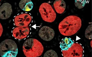 Nature 三連重磅！識破癌細胞的“詭計”，為結直腸癌患者帶來新希望