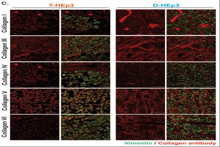 讓癌細胞“一睡不醒”！向腫瘤微環境中添加III型膠原蛋白可防止腫瘤復發和轉移