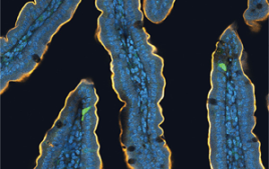 喝完無糖飲料還想吃甜食？人們對糖的渴望，無法被甜味劑替代，答案都在腸道里！