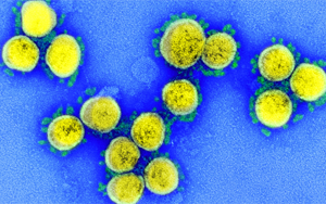 漏檢風(fēng)險將增加！奧密克戎新分支更隱匿