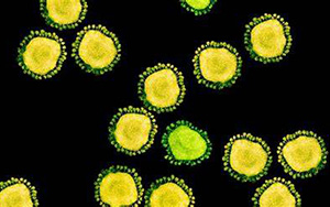 傳播速度快！新變體BA.2.12.1“風(fēng)靡”北美