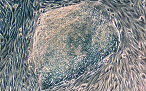 首次發現人類尿液來源的干細胞具有強大的再生潛力！