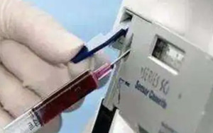 血氣分析技術介紹及產品一覽