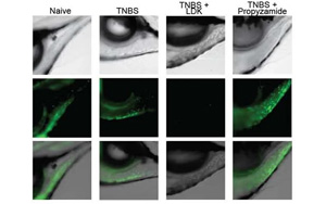 環境中的化學物質會增加炎癥性腸病的風險