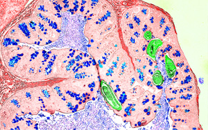 Nature新研究解答爭議，為炎癥性疾病的免疫機制提供新見解
