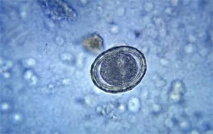 讓培養皿“患上”PTSD，然后為人類拓寬治療手段