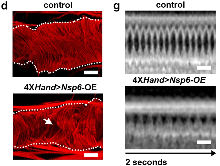 UAS-SARS-CoV-2Nsp6轉(zhuǎn)基因的4XH和Gal4、成纖維細(xì)胞特異性過表達(dá)（OE）誘導(dǎo)的成人心臟表型