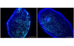 Nature：恢復活力的免疫細胞能更好地清除大腦中的有毒廢物