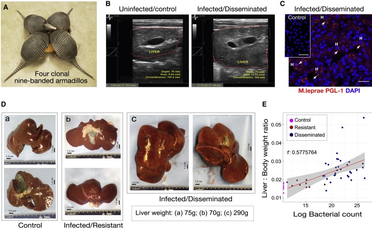 麻風分枝桿菌促進成年九帶犰狳體內正常肝臟器官生長而無肝損傷