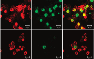 Nature Aging：觸發大腦的免疫細胞可以減緩阿爾茨海默病