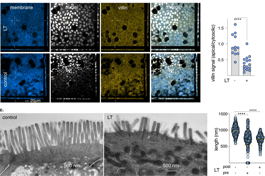 熱不穩(wěn)定毒素?fù)p害小腸微絨毛的有效形成