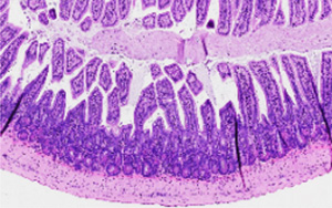 一種化合物可以逆轉小鼠的腸道炎癥