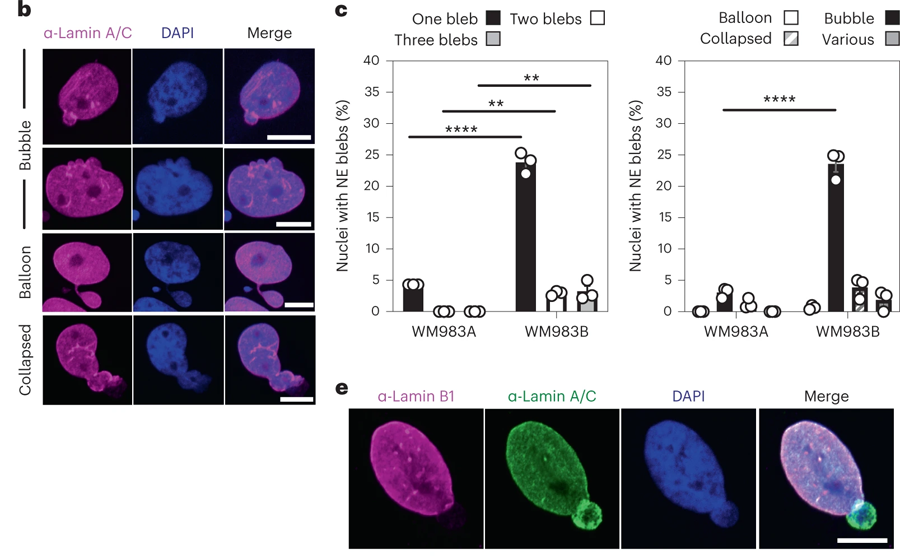 轉移性黑色素瘤細胞的NE(核包膜蛋白）是高度活躍的