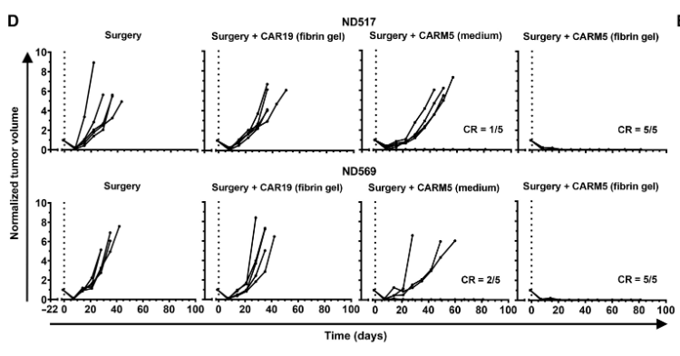 纖維蛋白凝膠中的CAR-T細胞在TNBC異種移植模型中有效清除術后殘留腫瘤細胞
