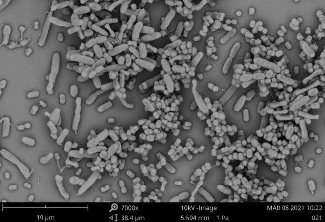 掃描電鏡顯示肺炎克雷伯菌和鮑曼不動桿菌在生物膜中共同生長 掃描電鏡顯示肺炎克雷伯菌和鮑曼不動桿菌在生物膜中共同生長